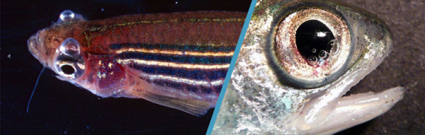 Эмболия газовая (Embolia gaseosa)